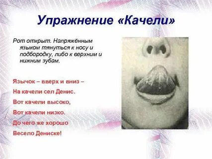 Артикуляционная гимнастика упражнение качели