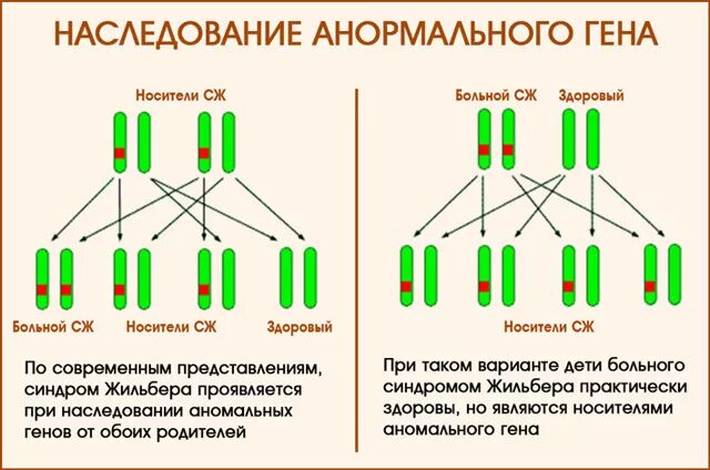 Генотипы жильбера. Жильбера Тип наследования. Тип наследования при синдроме Жильбера. Синдром Жильбера 6/7. Генотип 7/7 синдром Жильбера.