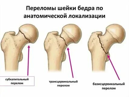 Через сколько операция перелом