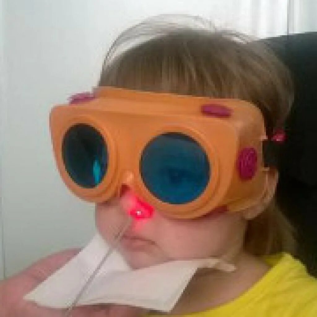 Уфо лор органов. Аденоиды лазеролечение. Аэротерапия лор органов. Очки для лазеротерапии. Лазерная физиотерапия аденоидов у детей.