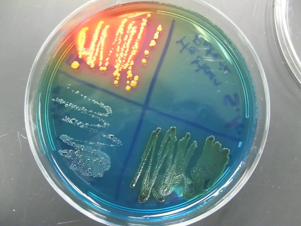 Spp salmonella spp shigella spp