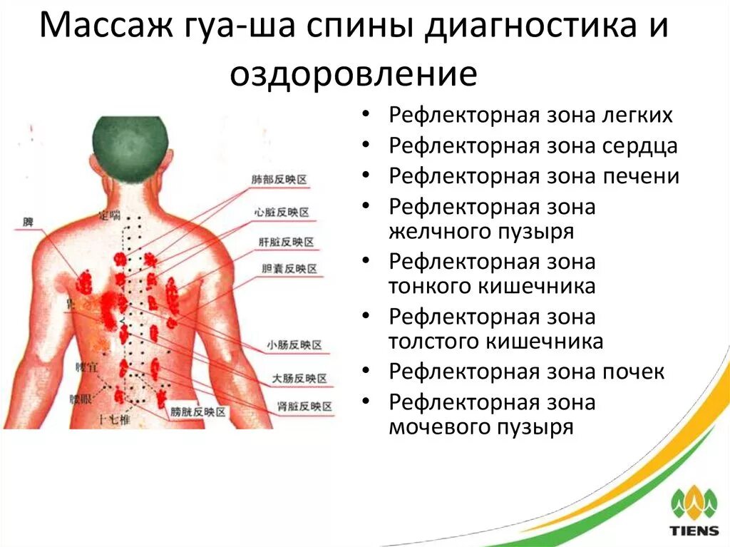 Точки после массажа. Массаж спины скребком Гуаша схема. Массаж тела скребком Гуаша схема. Массаж Гуаша для спины схема. Массаж Гуаша схема направления движения.