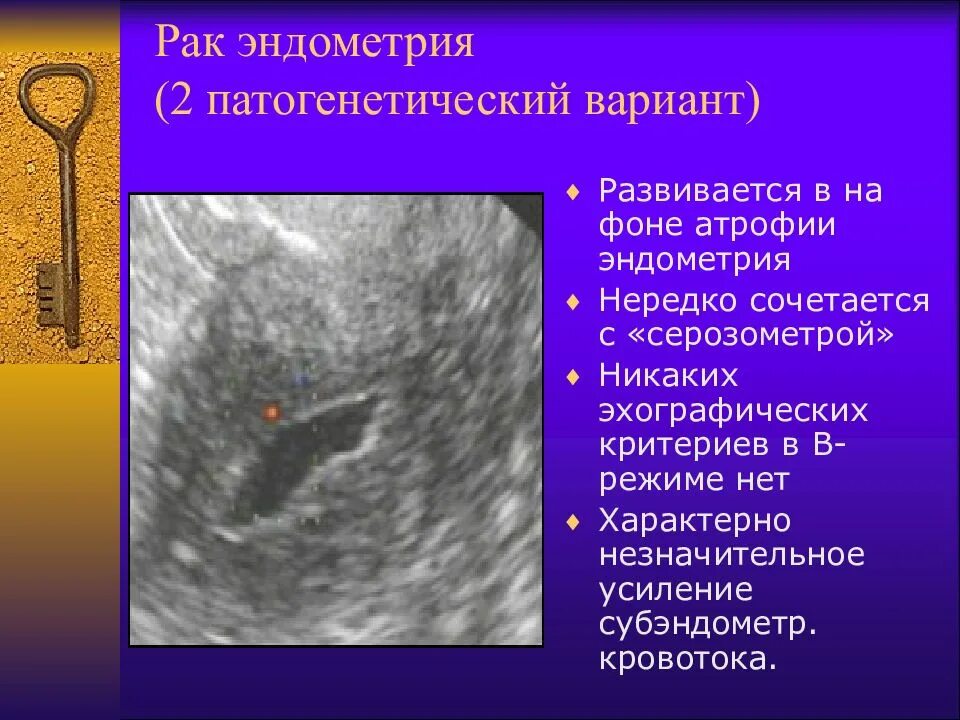 Эндометрии в полости. Гиперплазия эндометрия полипоз эндометрия).. Эндометриальный аденокарцинома. Злокачественные опухоли эндометрия. Аденокарцинома эндометрия УЗИ.