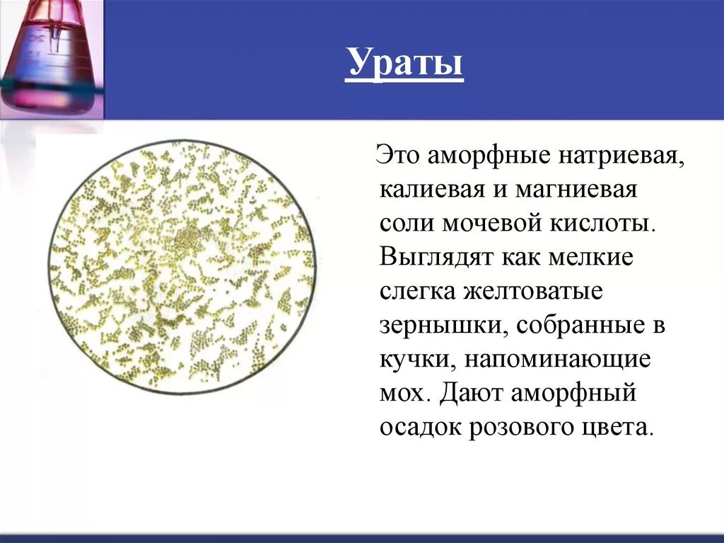 Ураты в моче. Аморфные Ураты в моче микроскопия. Осадок уратов в моче. Соли Ураты в моче.