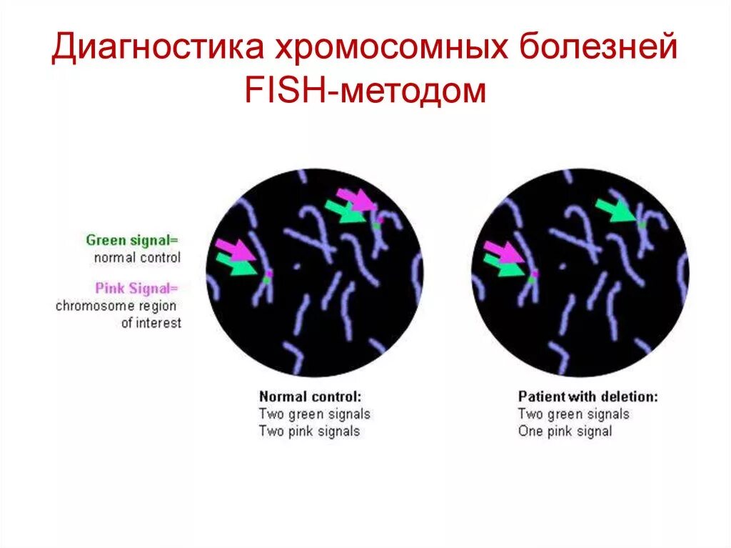 Метод изучения хромосомных. Цитогенетические методы диагностики хромосомных болезней. fish метод диагностики генетика. методы диагностики хромосомных болезней человека. методы лабораторной диагностики хромосомных болезней.
