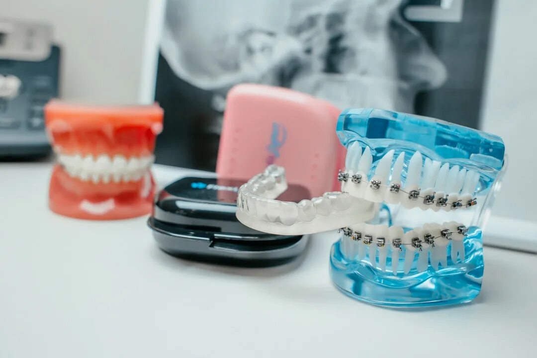 Установка элайнеров. Набор элайнеров standart 21. набор элайнеров 3d smile.