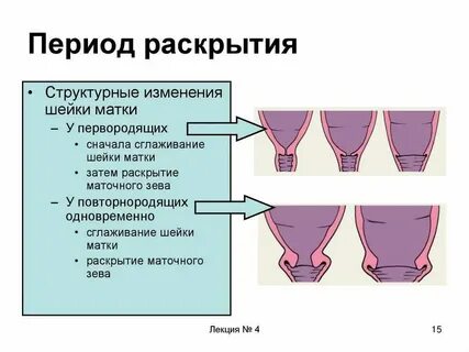Сколько см раскрытие при месячных