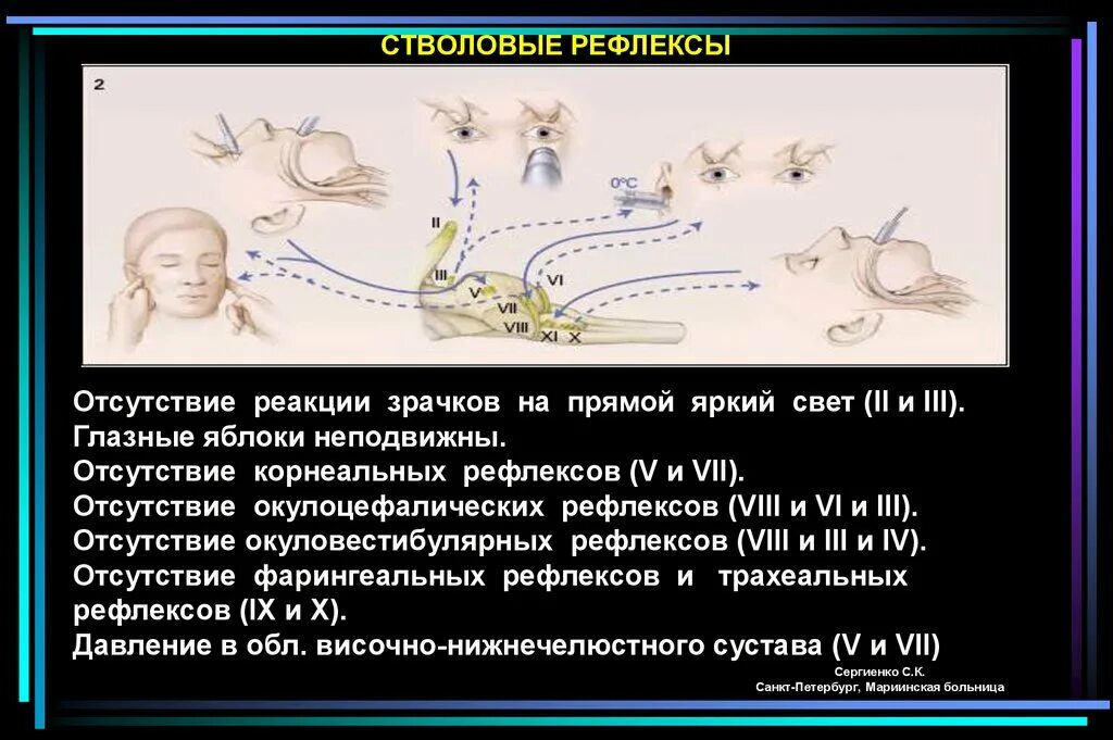 Стволовые рефлексы. Отсутствие рефлексов. Отсутствие корнеального рефлекса. Корнеальные рефлексы.