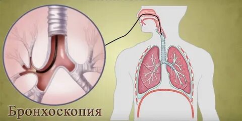 Сделать легких в москве
