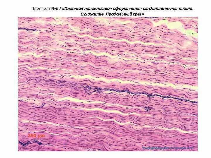 Связки гистология. Плотная оформленная соединительная ткань препарат гистология. плотная волокнистая неоформленная соединительная ткань гистология. плотная волокнистая неоформленная соединительная ткань препарат. плотная неоформленная соединительная ткань гистология.