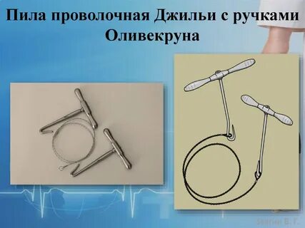 Джигли
