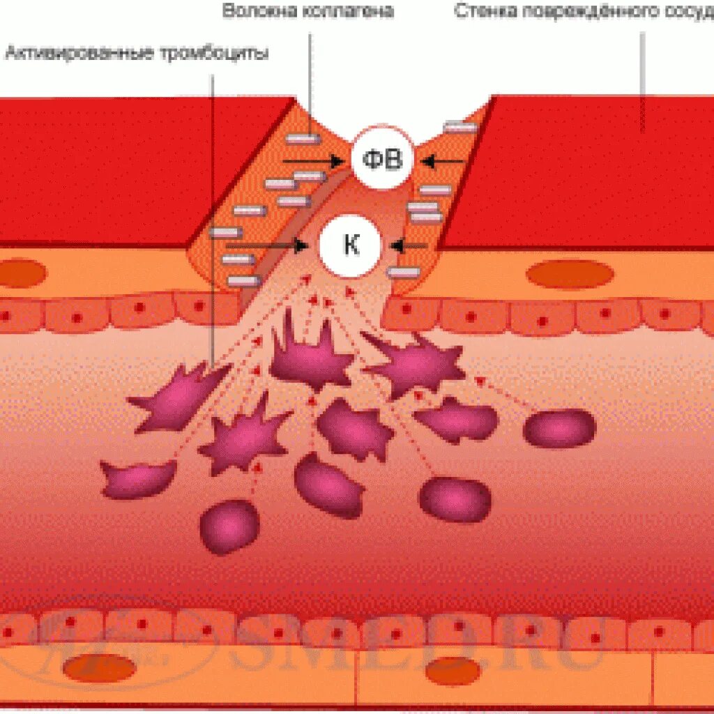 При повреждении сосудов тромбоциты. Болезнь Виллебранда тромбоциты. Повреждение эндотелия сосудов. Поврежденные стенки сосудов. Что повреждает эндотелий сосудов.