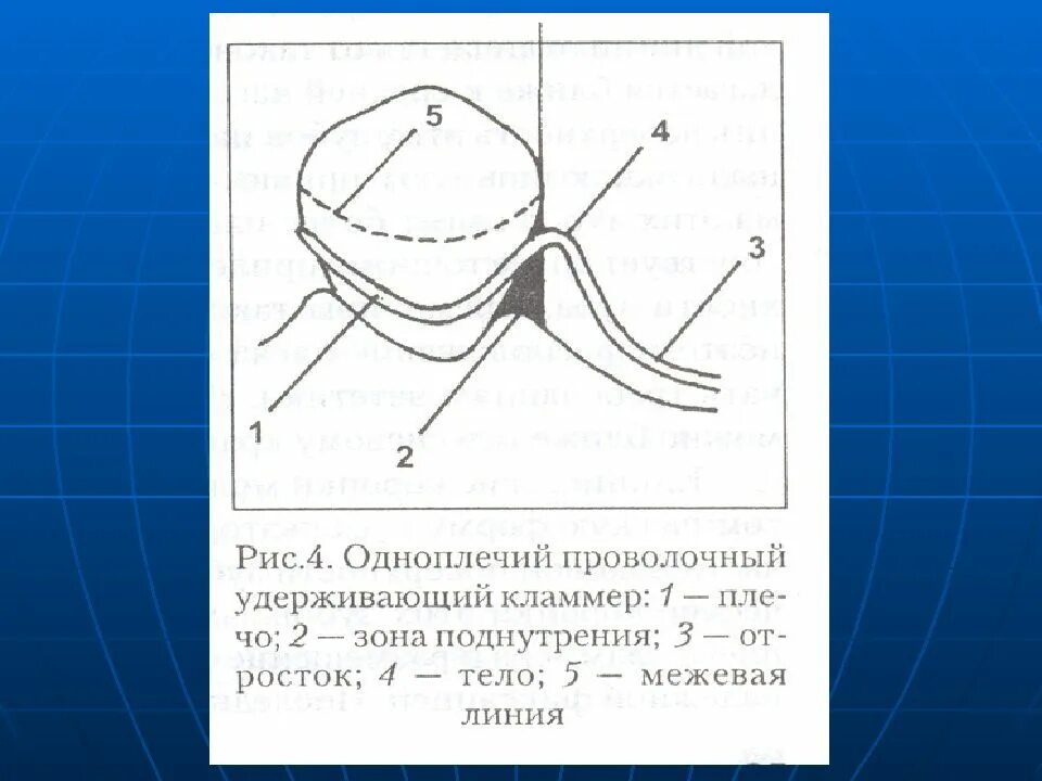 Опорно удерживающий кламмер: найдено 88 изображений