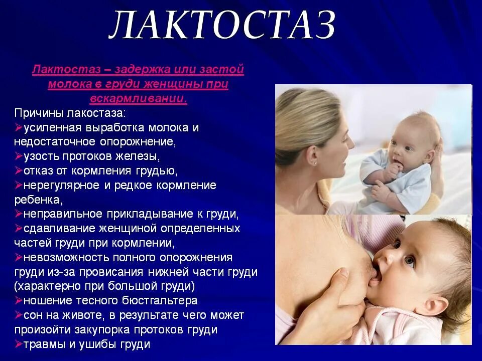 Что такое лактостаз. Лактостаз. застой при грудном вскармливании. застой в груди при гв.