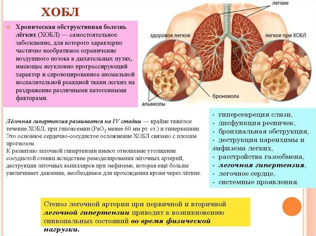 Опасное заболевание легких