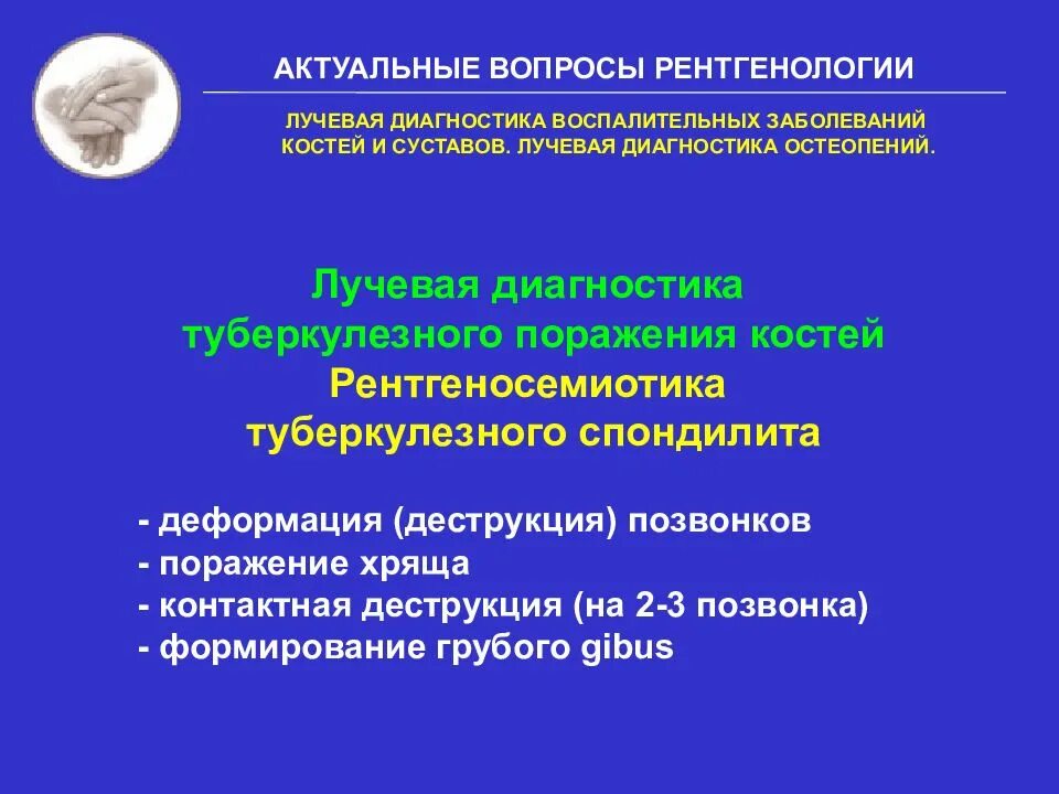 Альбуминозный остеомиелит олье. Рентгенологические синдромы патологии костно-суставного аппарата. Гематогенный остеомиелит плечевой кости рентген. Воспалительные заболевания кости. Лучевая диагностика лекции.