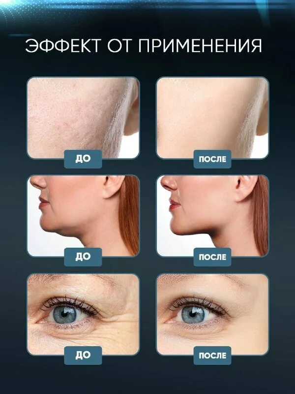 Массажер asia care. Массажер asia care. Вибрационный массажер eyestick light. Массажер asia care. Массажер asia care.