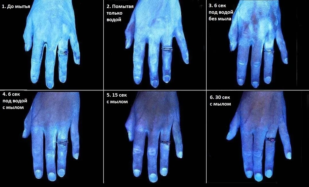 Что будет если не мыть руки. Мытье рук под ультрафиолетом. Бактерии на руках. Микробы под ультрафиолетом.