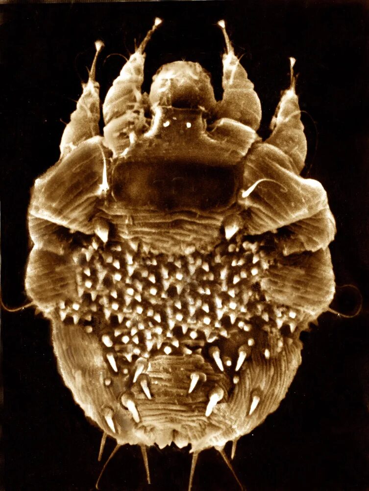 Pin on The Truth About Head Lice