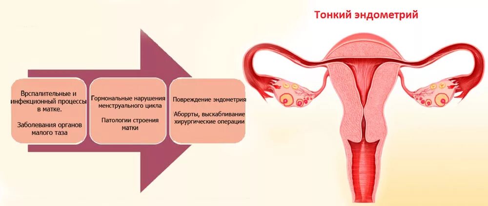 Тонкий эндометрий после. Нарастание эндометрия причины.