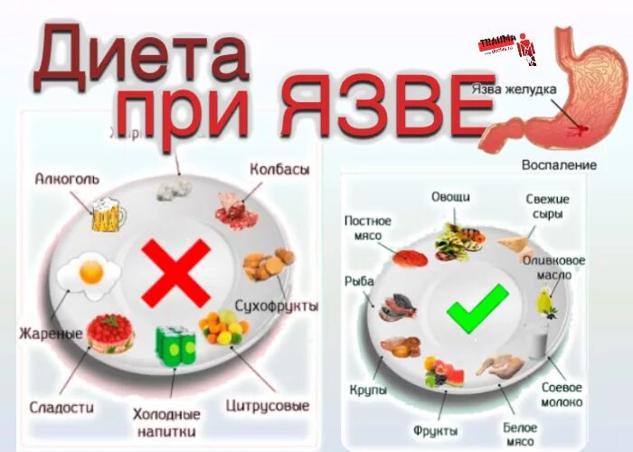 Продукты при язве желудка и двенадцатиперстной кишки. Рацион питания при язве желудка. Пищевой рацион при язвенной болезни желудка. Памятка для пациента с язвенной болезнью желудка. Язвенная болезнь желудка диета памятка.