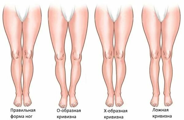 Какие ноги бывают у людей