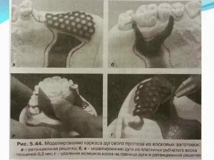 Проверка протезов
