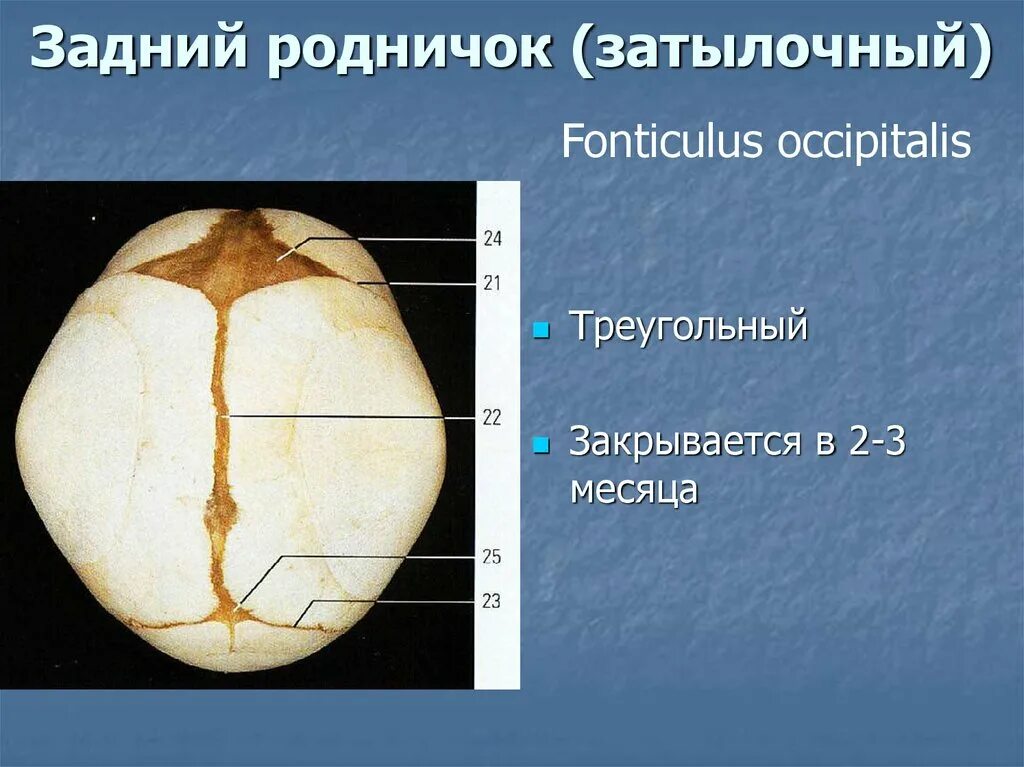 Размер родничка. Клиновидный и задний роднички.