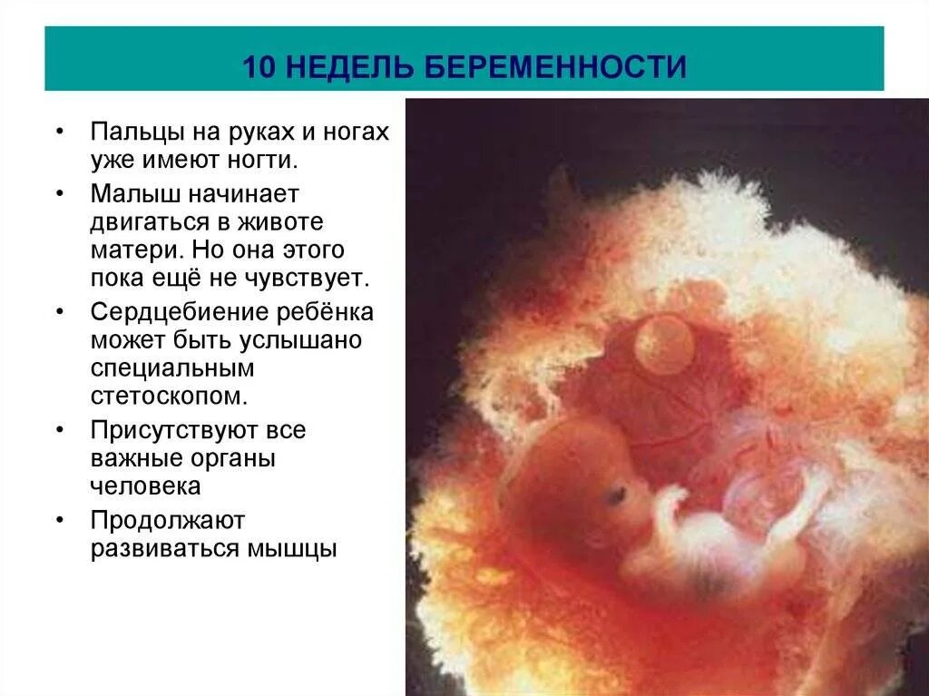 Как выглядит эмбрион на УЗИ 9-10 недель. Ребёнок на 10 неделе беременности. Размер эмбриона в 10 недель. Как выглядит эмбрион в 10 недель на УЗИ. Симптомы 10 недели