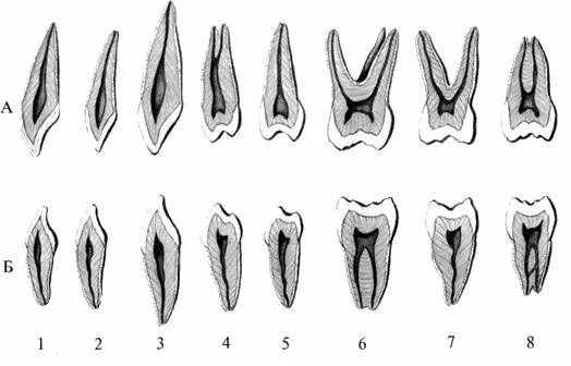Корень зуба клык. Корни зубов верхней челюсти и нижней челюсти. Корни 5 зуба верхней челюсти. Анатомия зубов верхней челюсти каналы. Анатомия корневых каналов зубов верхней челюсти клык.