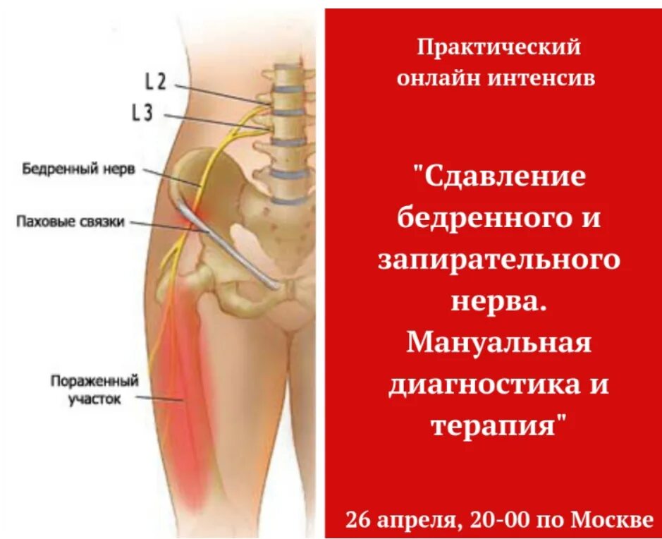 Нейропатия бедра. Латеральный кожный нерв бедра иннервация. Латеральный нерв бедра анатомия. Кожный нерв бедра анатомия.