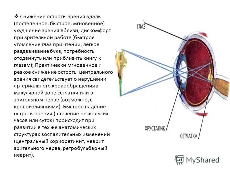 таблицы для зрения головина сивцева. острота зрения вдаль. таблица для определения остроты зрения. таблица д а сивцева для исследования остроты зрения.
