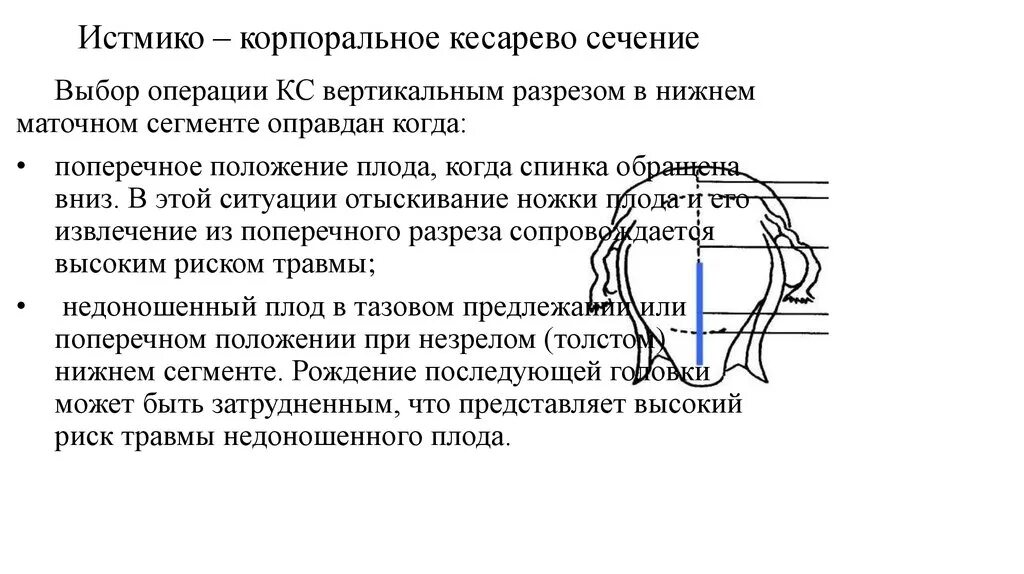 Операция сечения. Корпоральное кесаревосечеие. методика корпорального кесарева сечения. разрезы при кесаревом сечении. разрезы на матке при кесаревом.