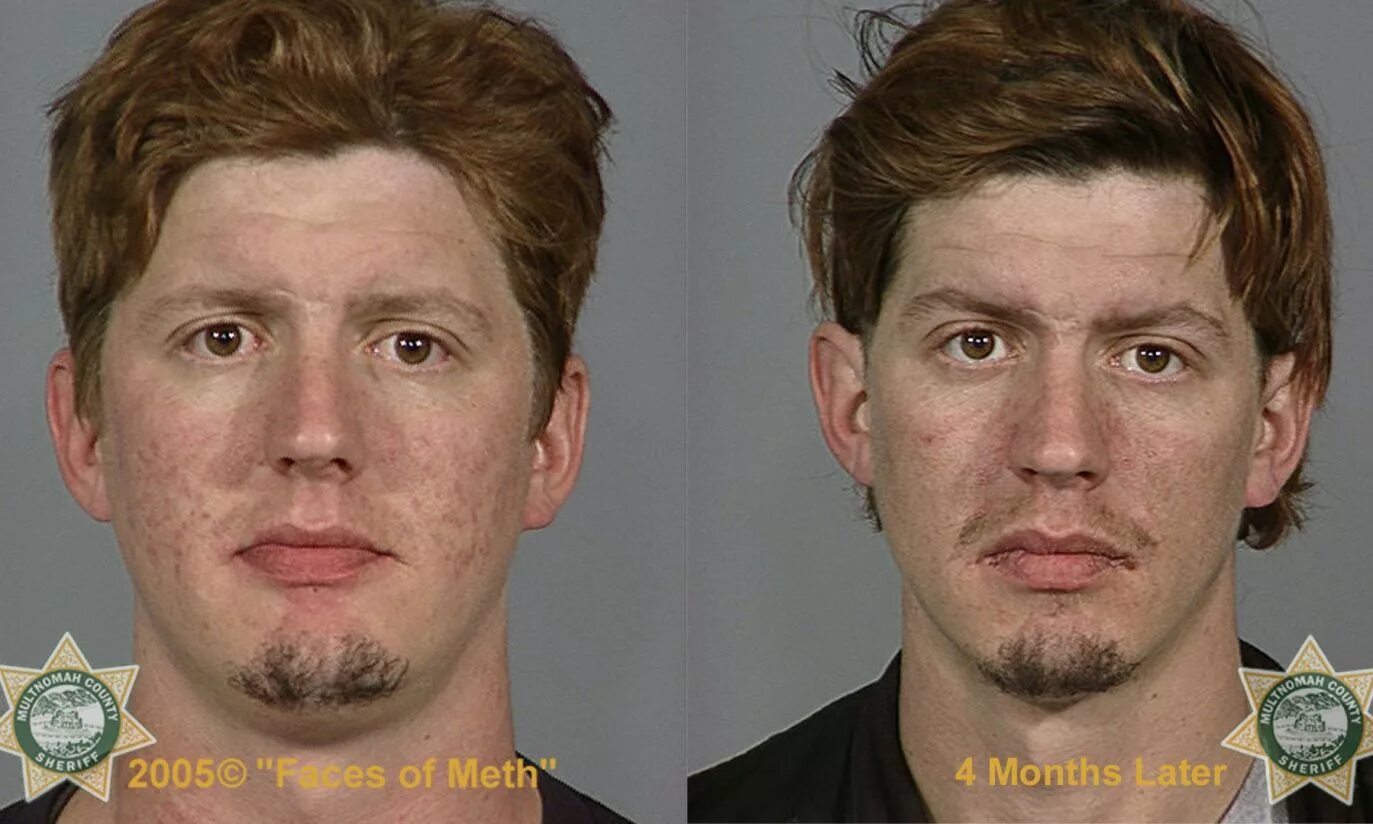 лицо человека созданное нейросетью.