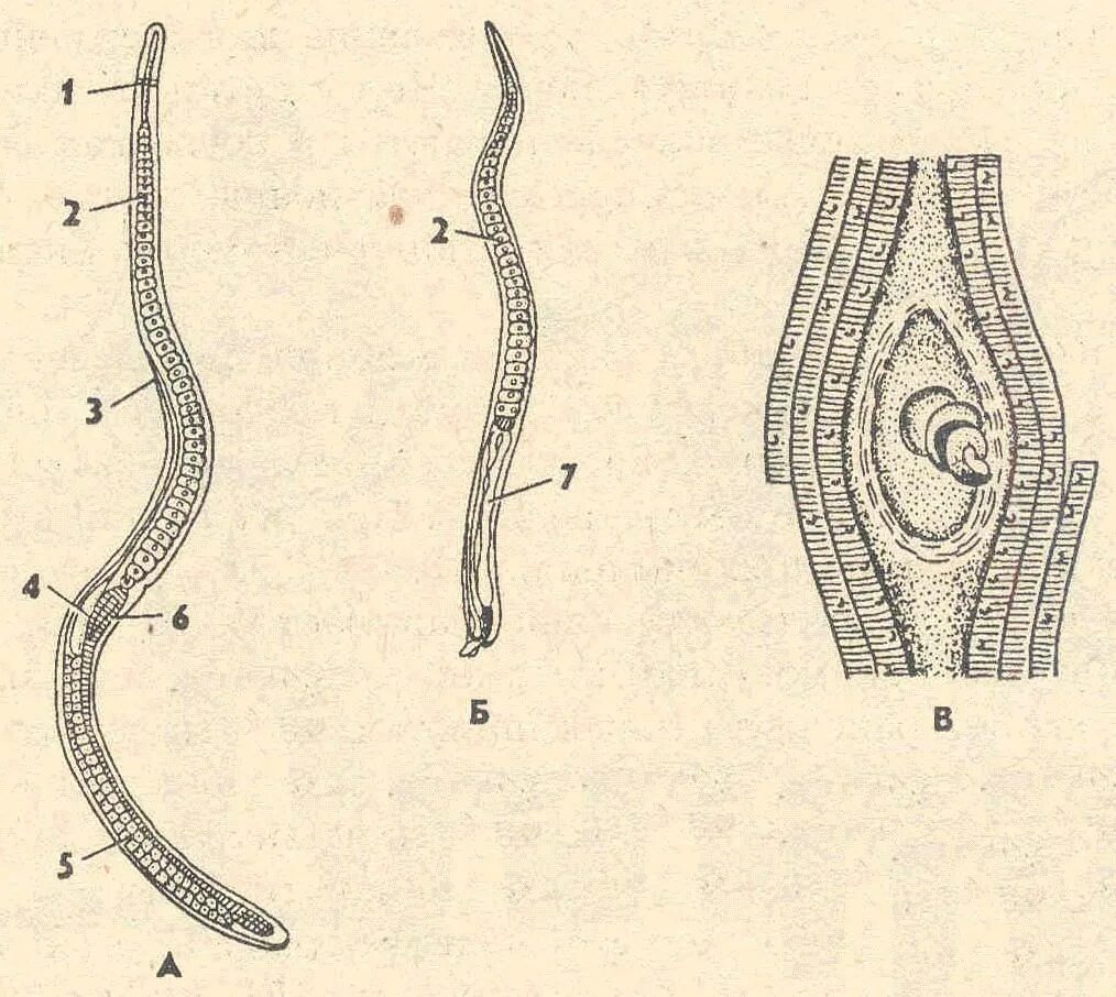 Личинки трихинеллы. Трихинелла (Trichinella spiralis). Трихинелла строение. Trichinella spiralis морфология. Трихинелла спиральная строение.