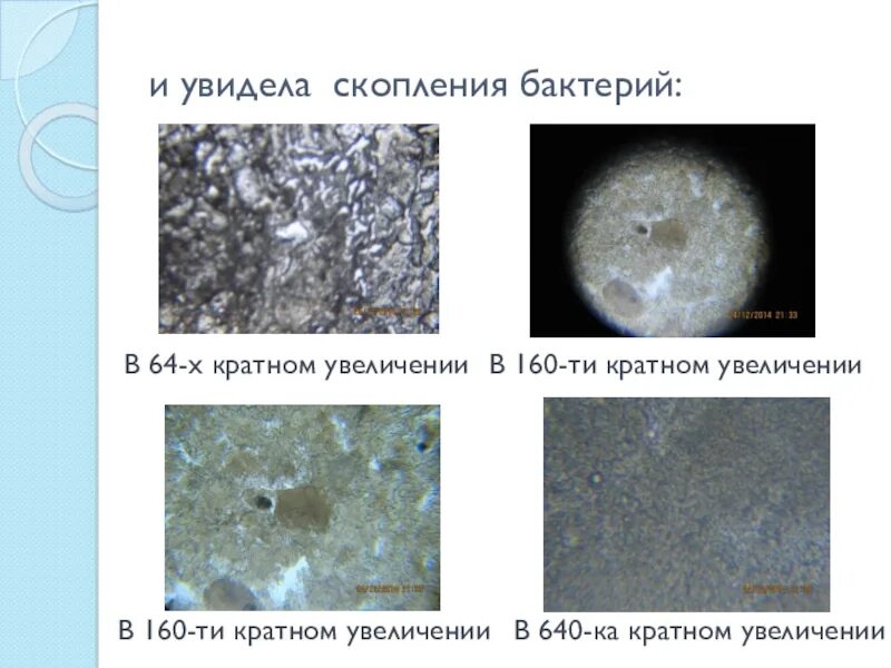 Большинство бактерий можно увидеть. Увеличение микроскопа чтобы увидеть бактерии. 400 Кратное увеличение. Увеличение микроскопа. Увеличение микроскопа для бактерий.