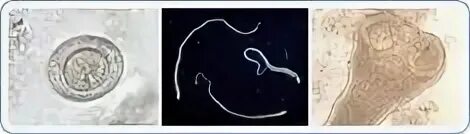 Cyniclomyces guttulatus у собак в кишечнике. Гименолепидоз систематика. Исследование на гименолепидоз. Гименолепидоз возбудитель. Hymenolepis nana под микроскопом.