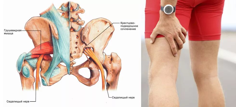 Тазобедренный отдает в поясницу. Крестцово-подвздошное сочленение и седалищный нерв. Седалищный нерв анатомия мышцы. Седалищный нерв крестец. Грушевидная и седалищный нерв.
