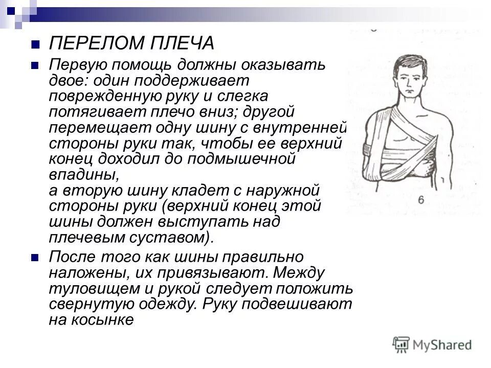 При подозрении перелом плеча у человека важно. Алгоритм оказания первой медицинской помощи при переломе плеча.. оказание первой помощи при закрытом переломе плеча. алгоритм оказания первой помощи при открытом переломе плеча. первая медицинская помощь при переломе плечевой кости.