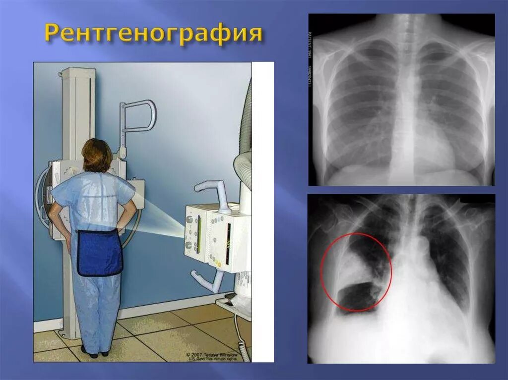 Рентген можно сделать. Рентгенологическое исследование органов грудной клетки. Рентгенография легких. Рентгеноскопия органов. Рентгеноскопия органов дыхания.