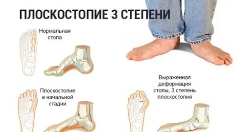 Можно ли на стадии