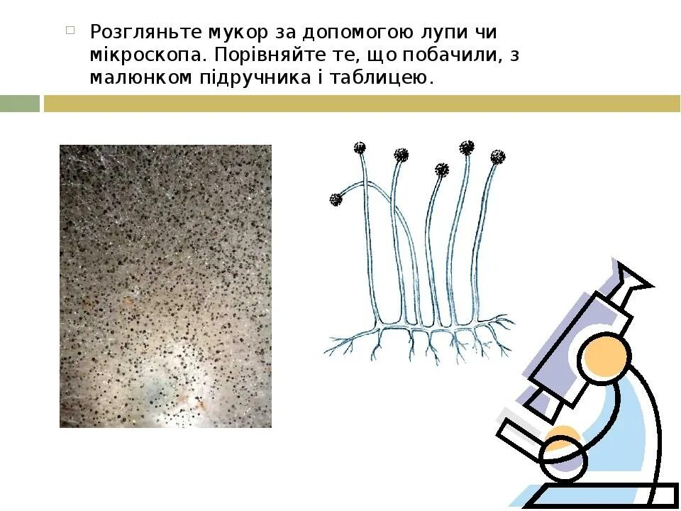 Многоклеточные грибы мукор. Мукор микроскоп увеличение 100. Строение плесени мукор. Мукор микроскоп увеличение 40. Мукор строение рисунок.