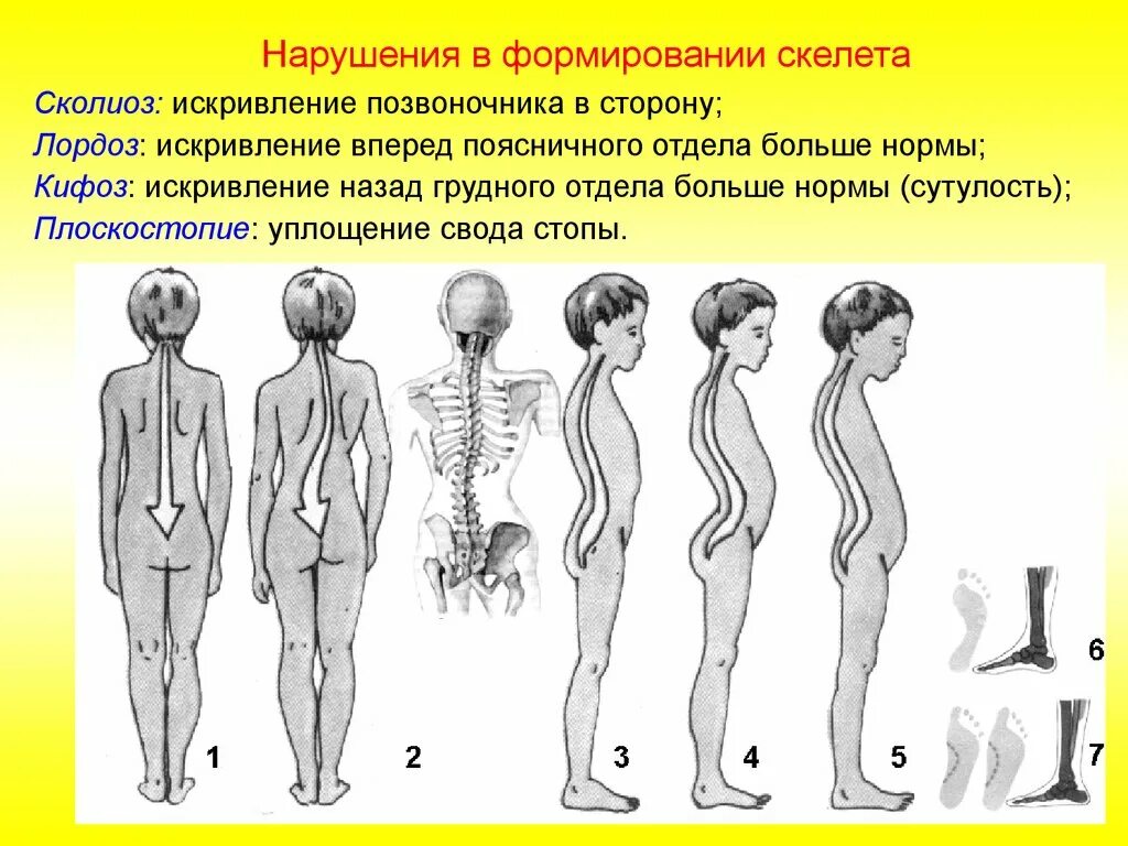 Нарушение роста скелета