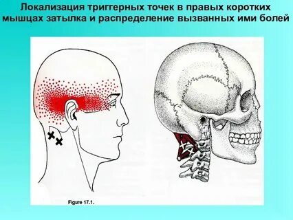 Болит голова внутри черепа