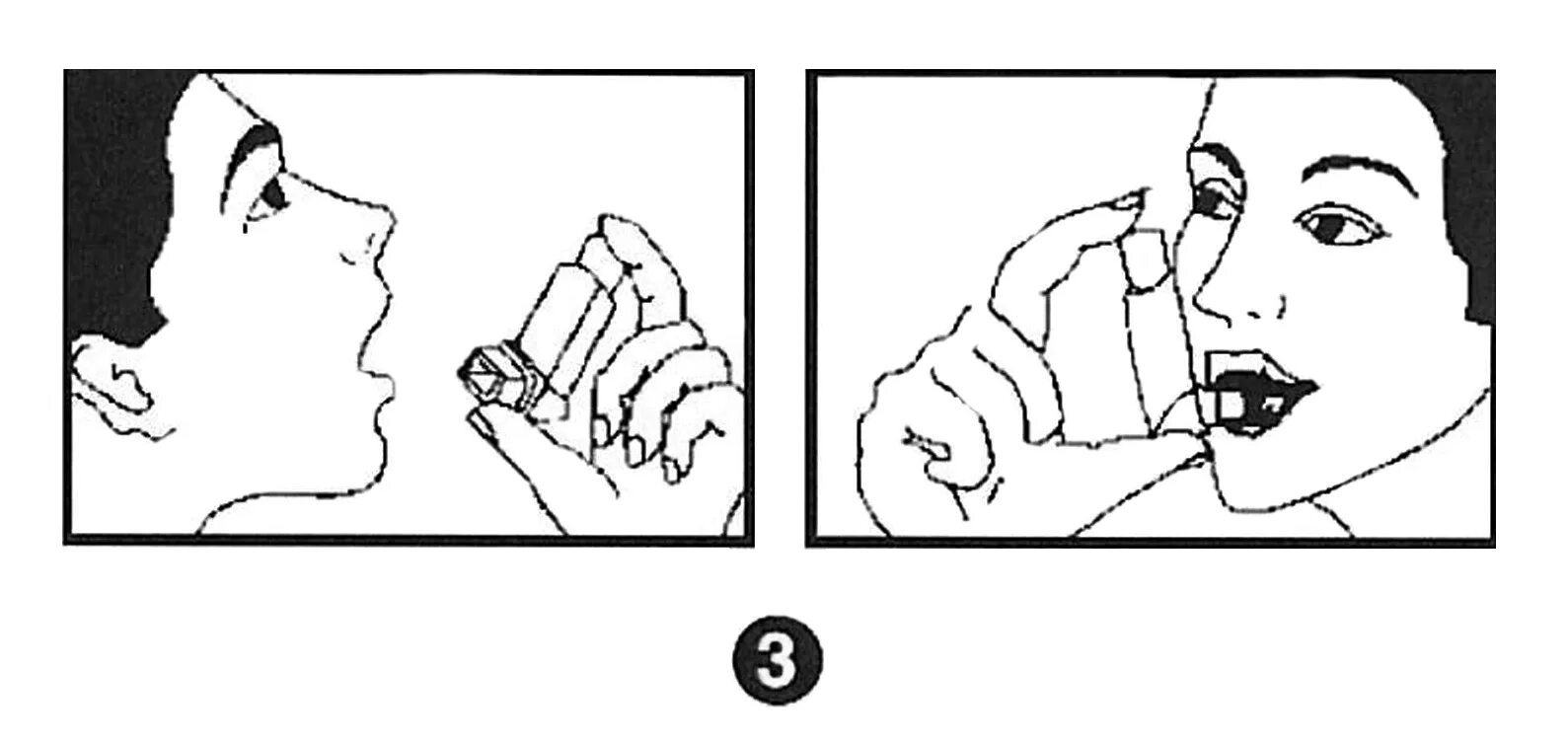 Через рот вводят. Карманный ингалятор через рот. Карманный ингалятор рисунок. Использование карманного ингалятора. Встряхивание карманного ингалятора.
