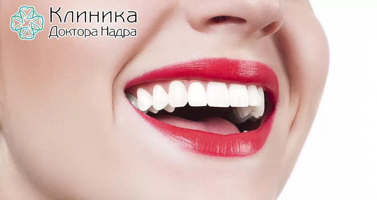 Песня белые зубы. Красивые ровные белые зубы. красивые виниры. белые зубы красные губы.
