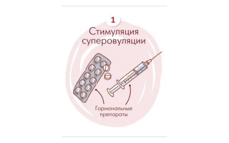 Магнитотерапия малого таза. Короткий протокол эко. Эко оплодотворение этапы. Экстракорпоральная стимуляция. Экстракорпоральная стимуляция.