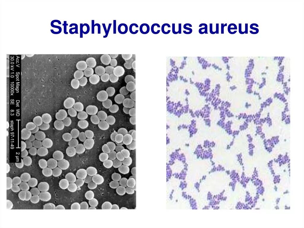 Стафилококк ауреус микроскопия. Стрептококк ауреус. Staphylococcus aureus микроскопия. Staphylococcus aureus под микроскопом.