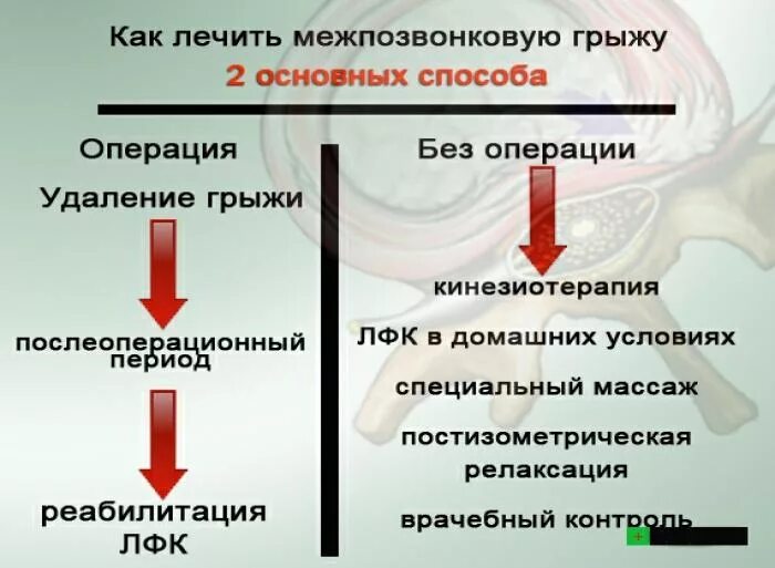 Консервативное лечение грыжи. Как вылечить межпозвоночную грыжу в домашних условиях.