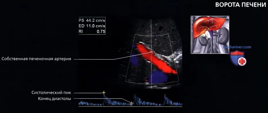 Размер печени у взрослого мужчины по узи. Печеночная артерия на УЗИ. Печеночные вены анатомия УЗИ. Сегменты печени при УЗИ. Печеночная артерия УЗИ норма.